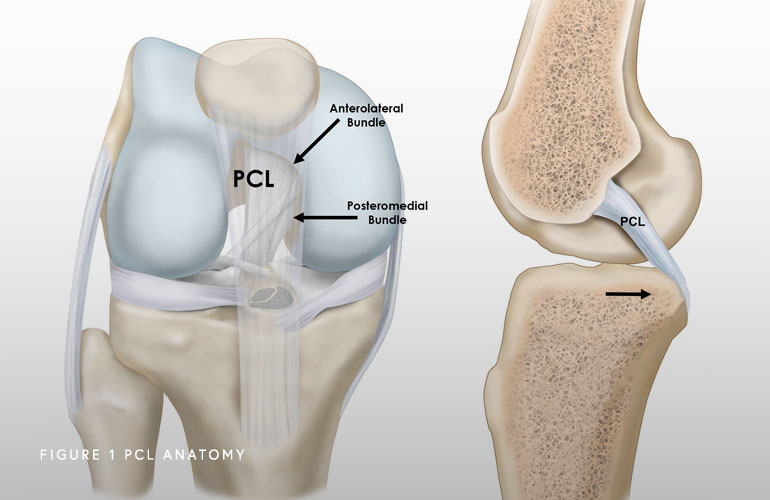Illustration of PCL Anatomy
