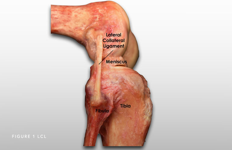 Image of Lateral Collateral Ligament