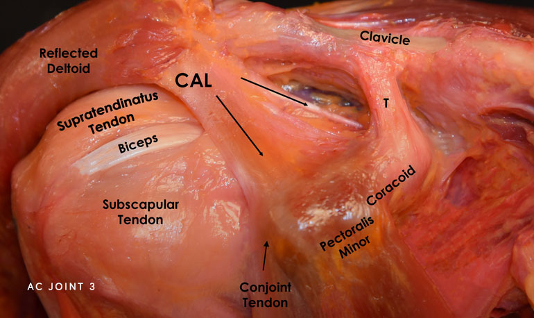 AC Joint Photo