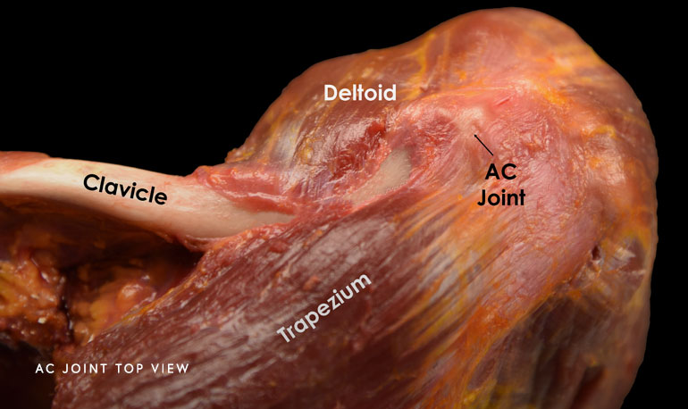 Photo of AC Joint Top View