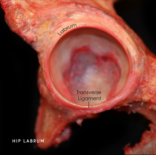 Hip Labrum Photo