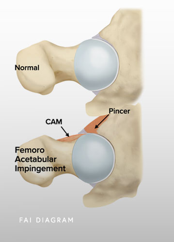 FAI Diagram