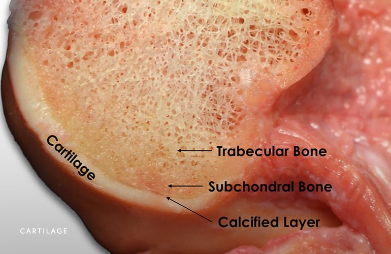 Image of Cartilage