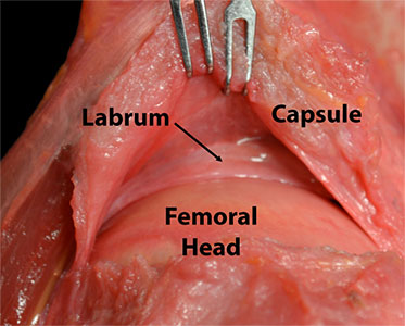 Photo of a Labrum
