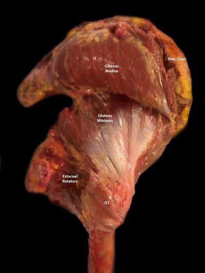 Photo of Gluteus Medius Muscle