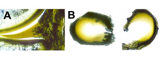 Image of blood flow in a meniscus 