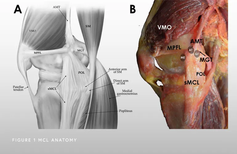 Image of MCL Anatomy