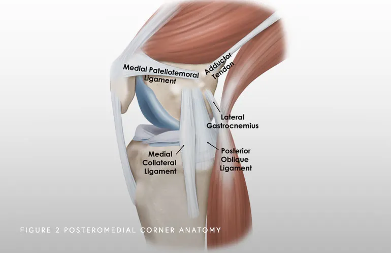 Image of Posteromedial Corner Anatomy