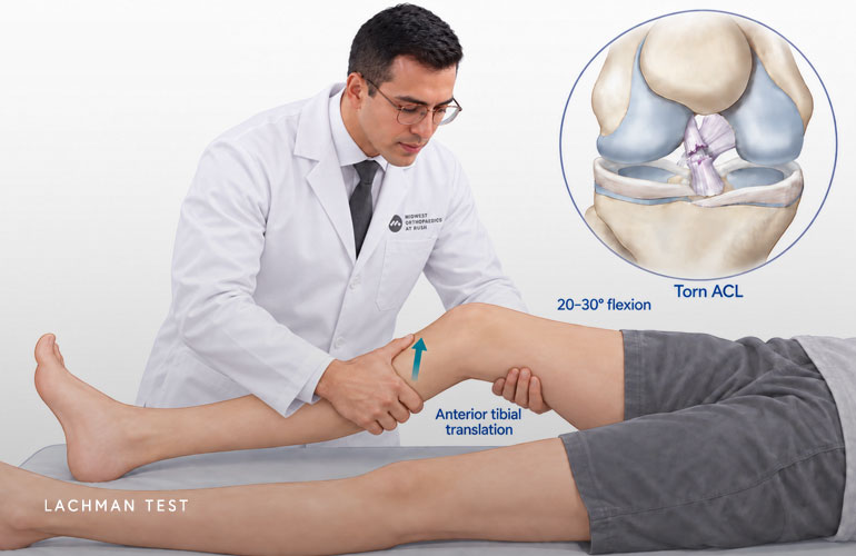 Dr. Jorge Chahla performing the Lachman test for ACL injury